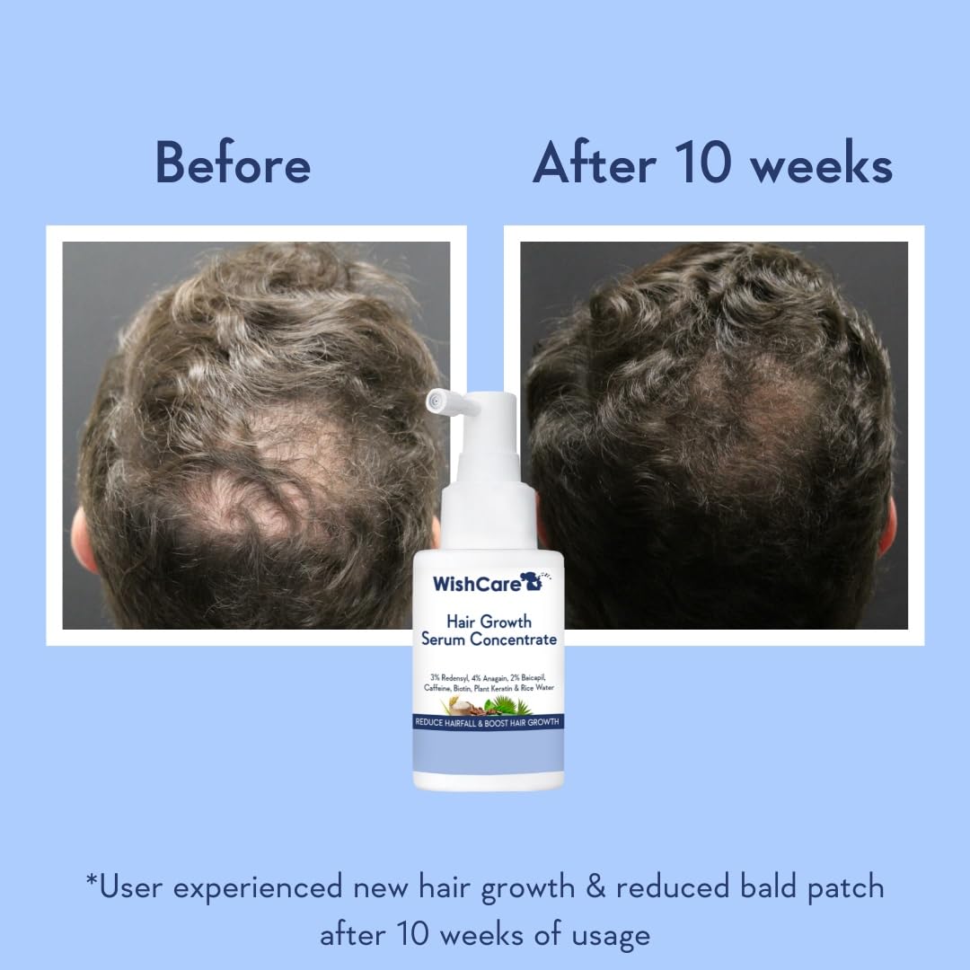 Wishcare Hair Growth Serum Concentrate With 3% Redensyl, 4% Anagain, Rice Water, Biotin - Distacart