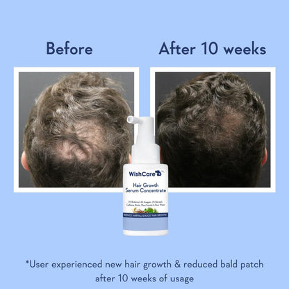 Wishcare Hair Growth Serum Concentrate With 3% Redensyl, 4% Anagain, Rice Water, Biotin - Distacart