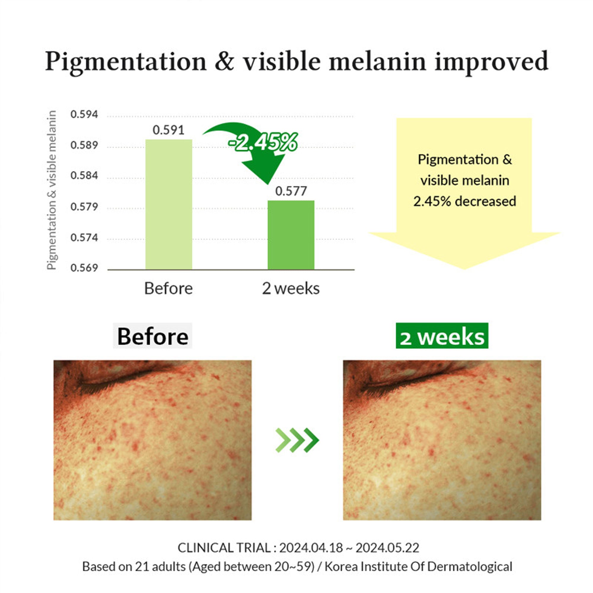 Dr.Althea Gentle Vitamin C Serum: Low-Irritation Brightening Serum for Sensitive Skin - Distacart