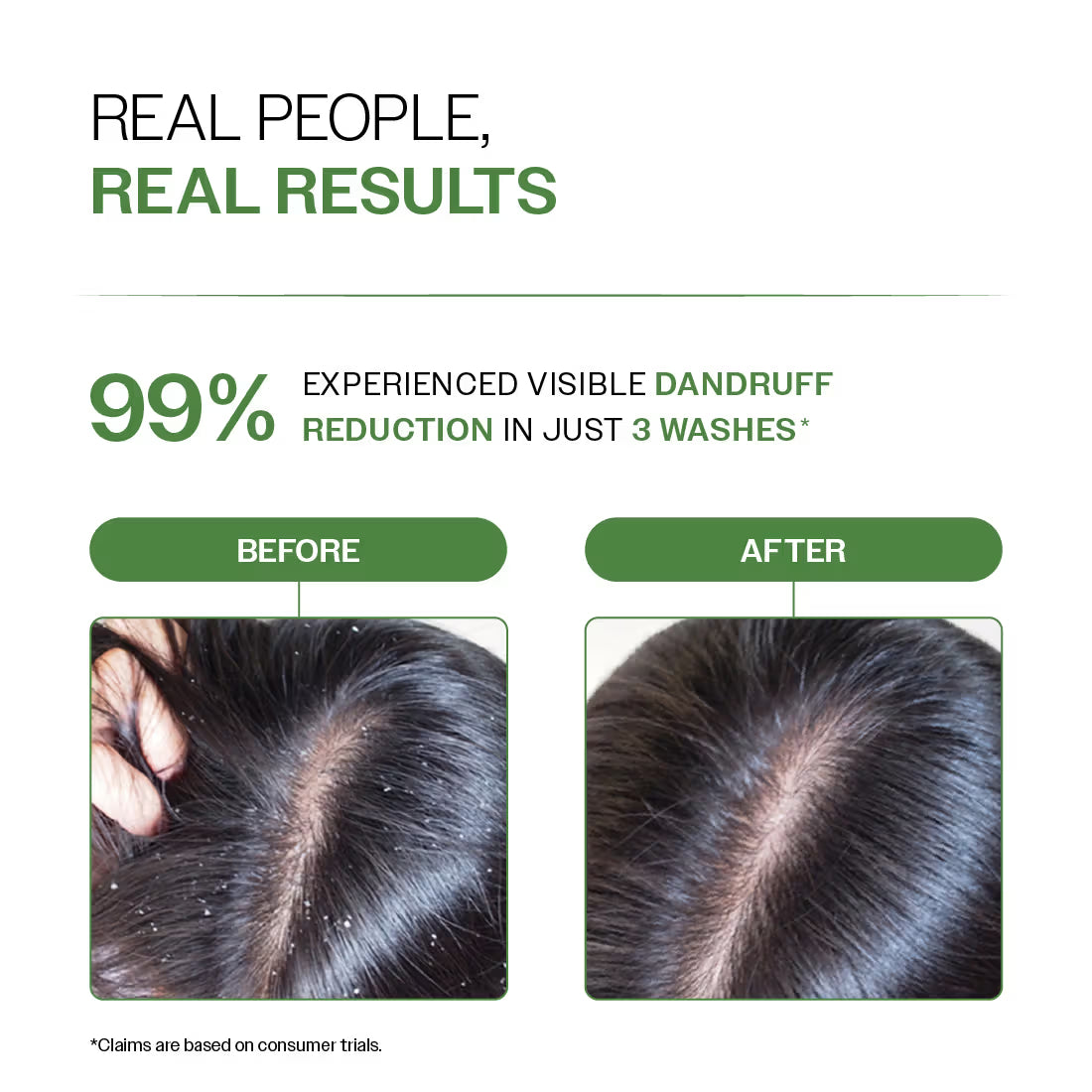 Bare Anatomy Expert Anti-Dandruff Shampoo with Salicylic Acid & Biotin - Distacart