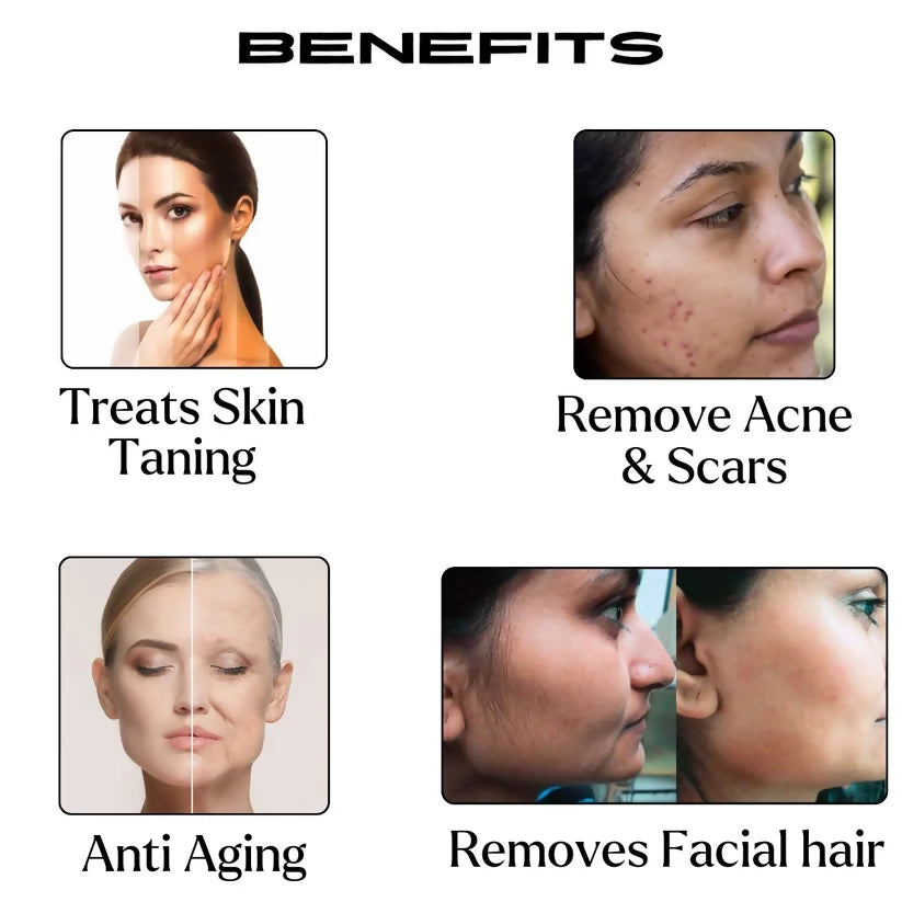 Etheric Anti Acne Face Pack – Natural Herbal Skin Clarifying Treatment - Dista