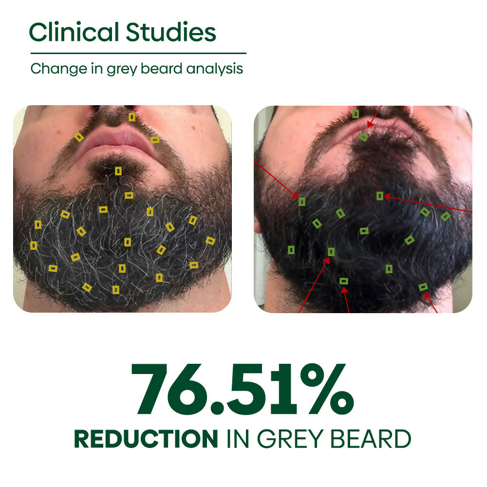 Copy of ANTI GREY BEARD OIL PERCENTAGE