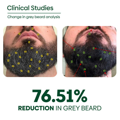 Copy of ANTI GREY BEARD OIL PERCENTAGE