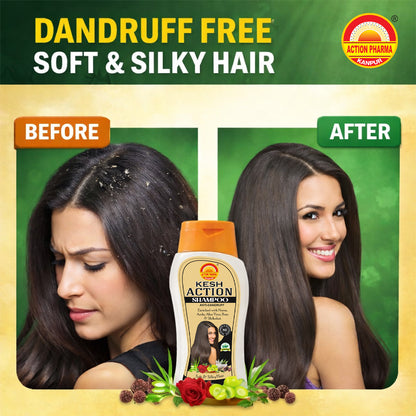 Action Pharma Shampoo Anti-Dandruff Enriched With Neem - Distacart