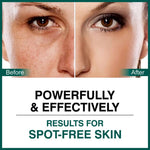 Thumbnail for She Essentials Dark Spot Corrector Cream, Niacinamide & Vitamin E Oil