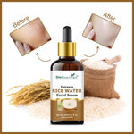 Thumbnail for She Essentials Rice Water Fairness Face Serum For All Types Of Skin