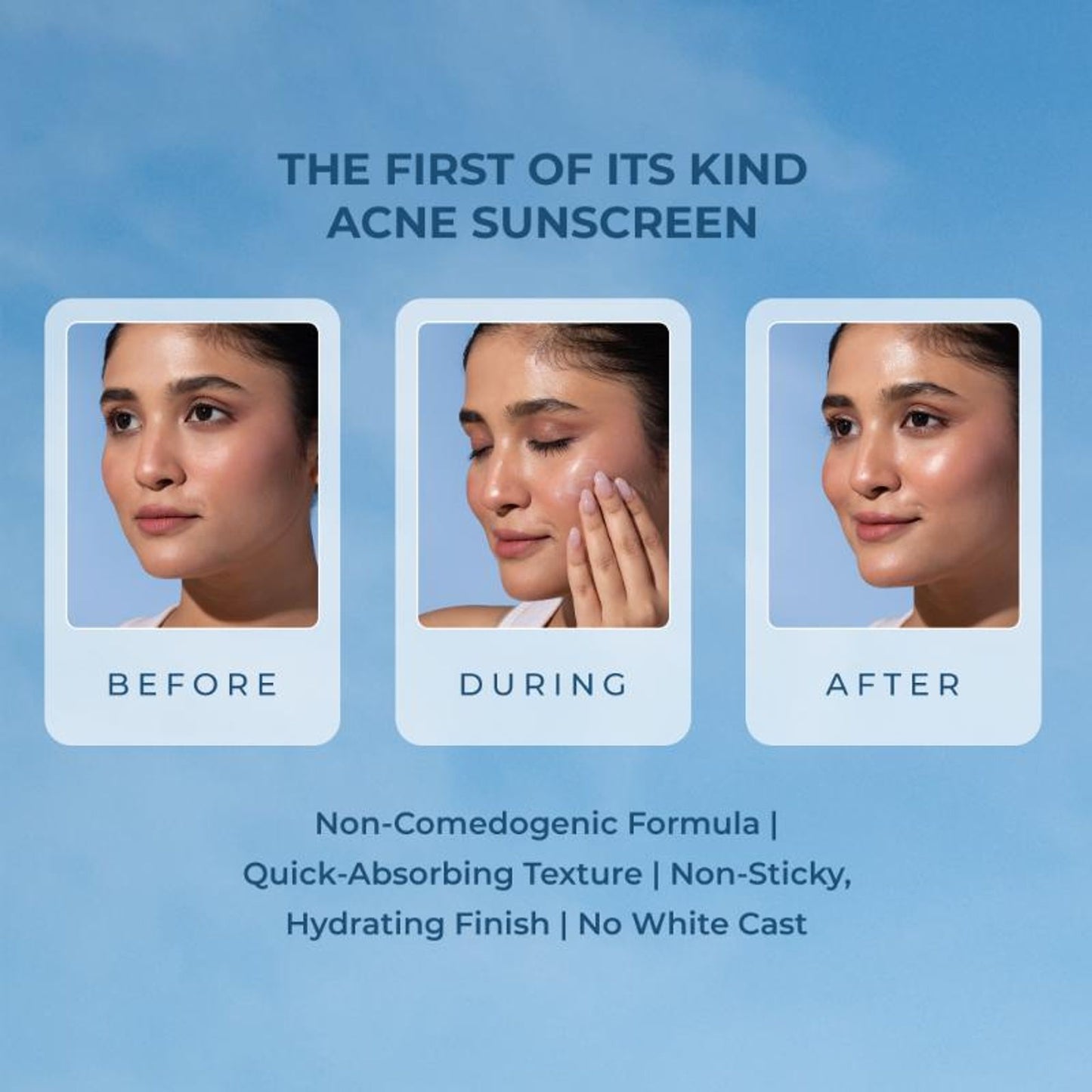 Naturali Acne Control Sunscreen SPF60 With PA+++ - Distacart