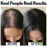 Thumbnail for Samisha Rosemary Water Spray For Hair Growth & Thickness - Distacart