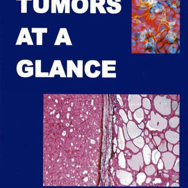 Tumors At A Glance: Volume 1-V K Jain - Dista