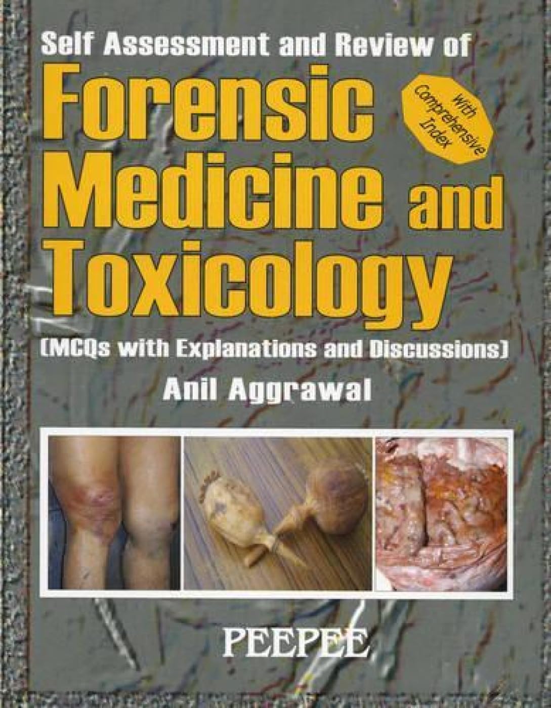 Self Assessment And Review Of Forensic Medicine: Volume 1-Anil Aggrawal - Dista