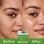 Thumbnail for Samisha Multi Purpose Aloe Vera Gel - Distacart