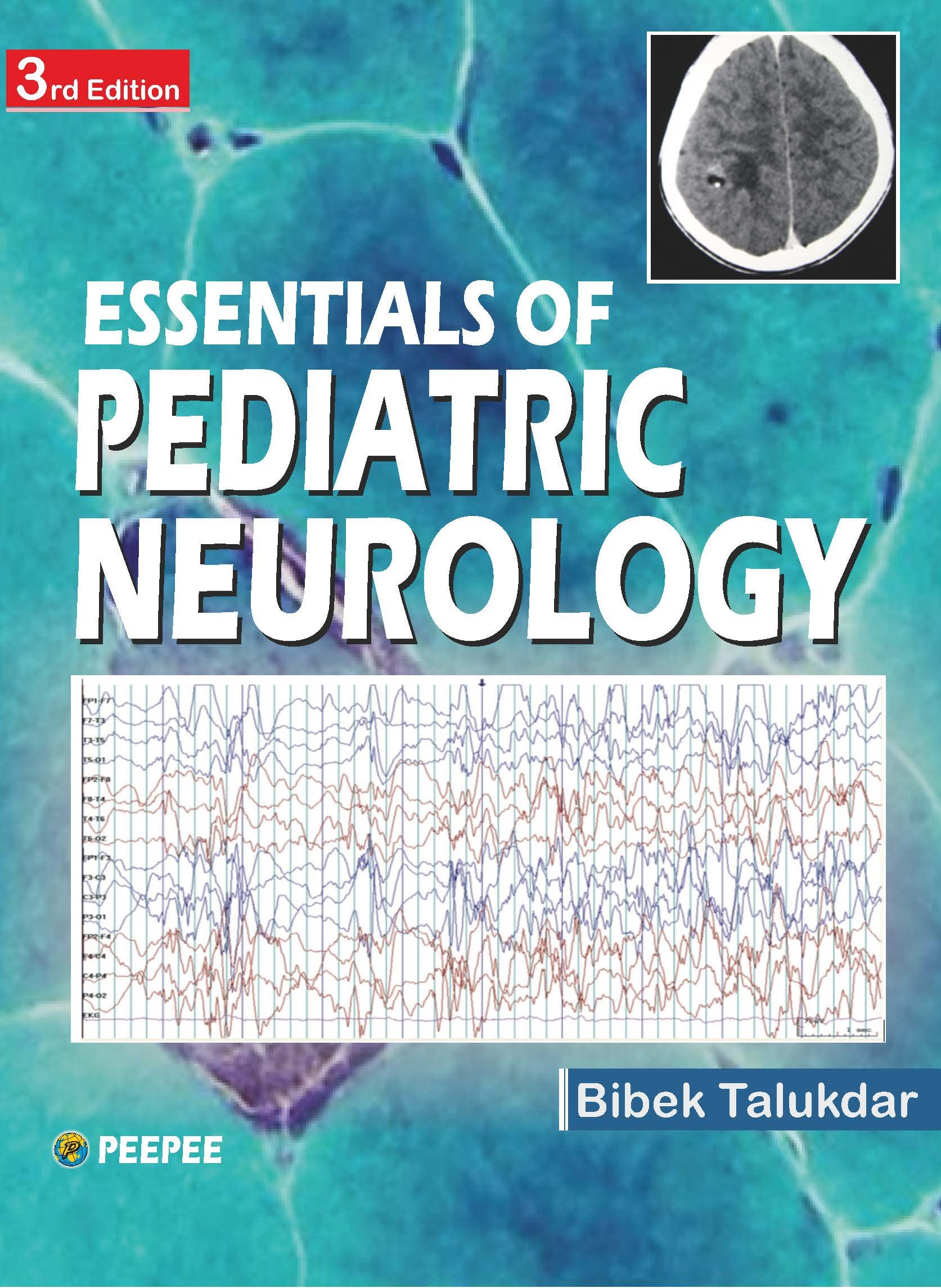 Essentials Of Pediatric Neurology 3E-Talukdar, Bibek - Dista
