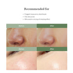 Thumbnail for Dr.Althea Premium Sebum Control Cleanser: Deep Pore & Blackhead Cleansing Gel - Distacart