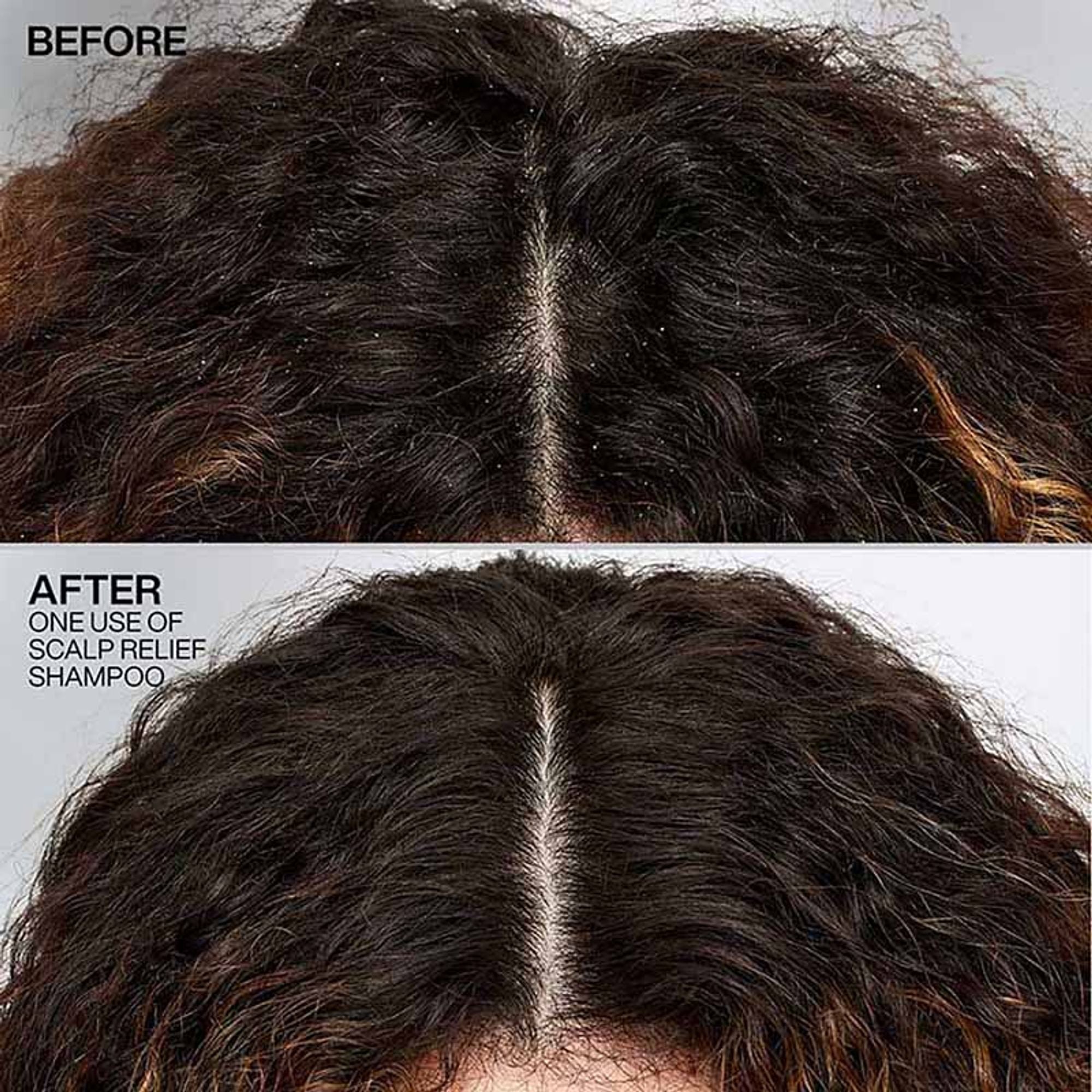 Redken Scalp Relief Anti Dandruff Shampoo For Men & Women - Distacart