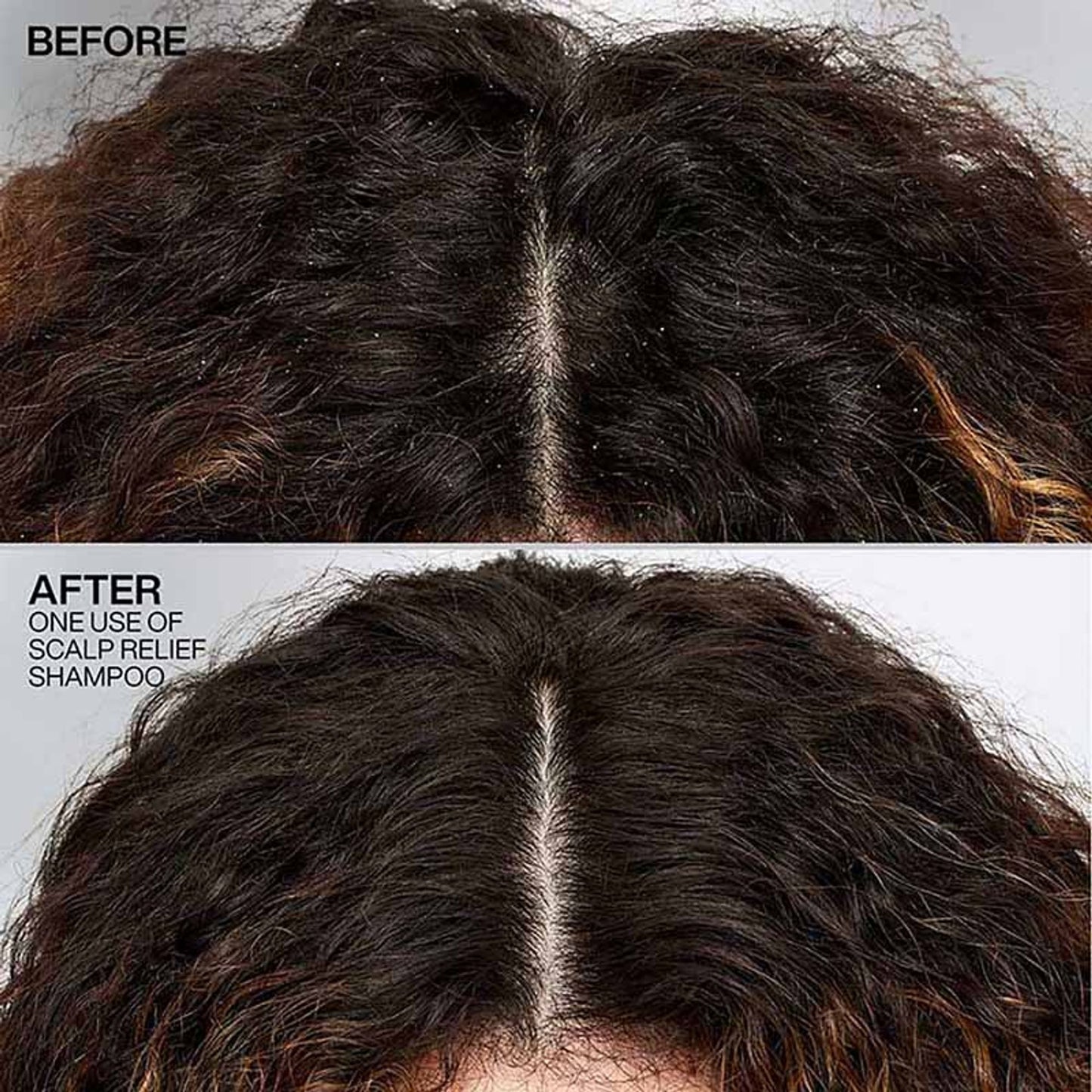 Redken Scalp Relief Anti Dandruff Shampoo For Men & Women - Distacart