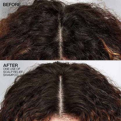 Redken Scalp Relief Anti Dandruff Shampoo For Men & Women - Distacart