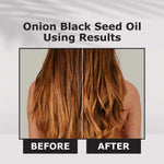Thumbnail for Nuerma Science Onion Black Seed Hair Oil - Distacart