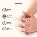 Thumbnail for Vedicderm Psoriasis Cream with 2% Bakuchi Extract - Distacart