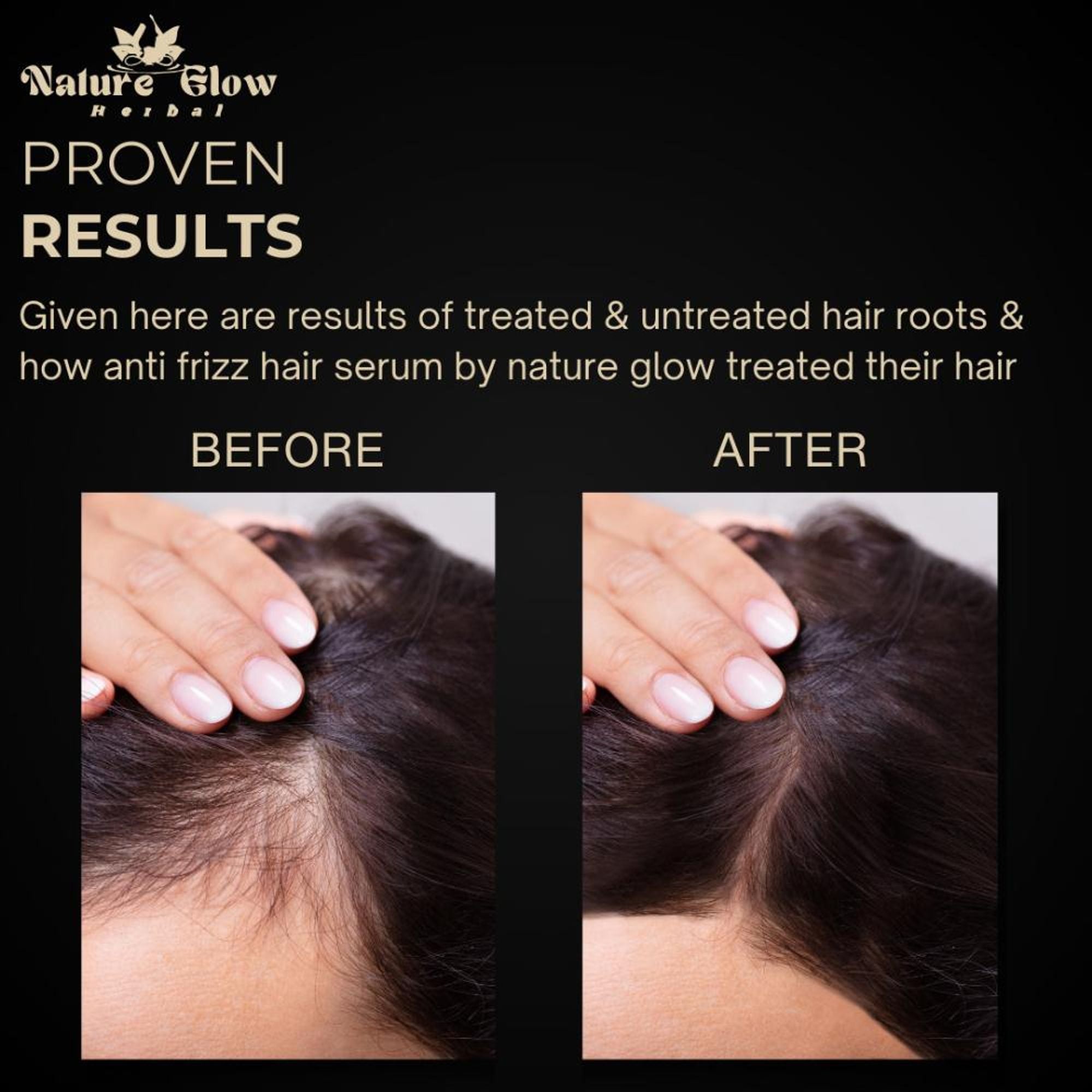 Nature Glow Herbal Anti Frizz Hair Serum - Distacart