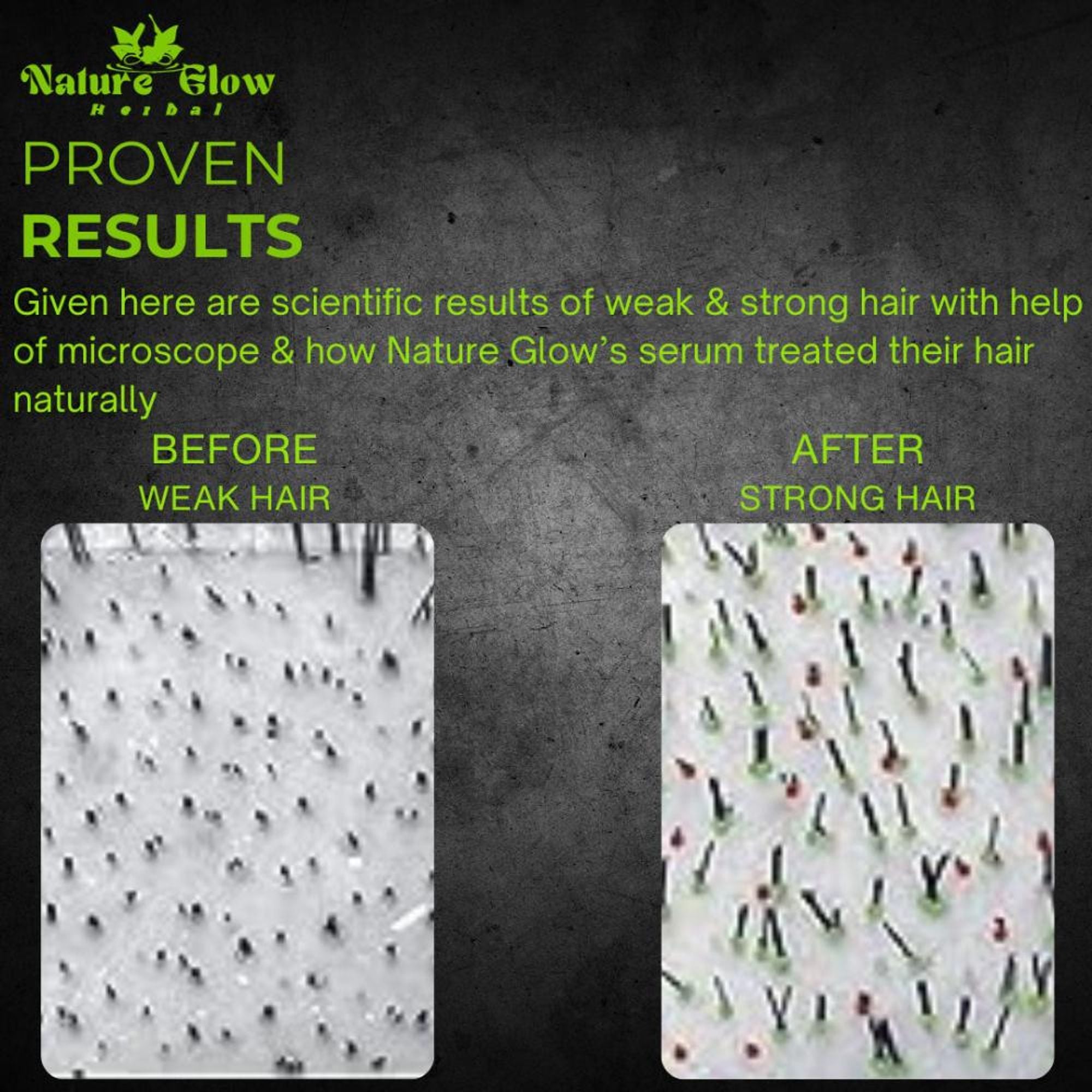 Nature Glow Herbal High Gloss Strengthen Hair Serum - Distacart