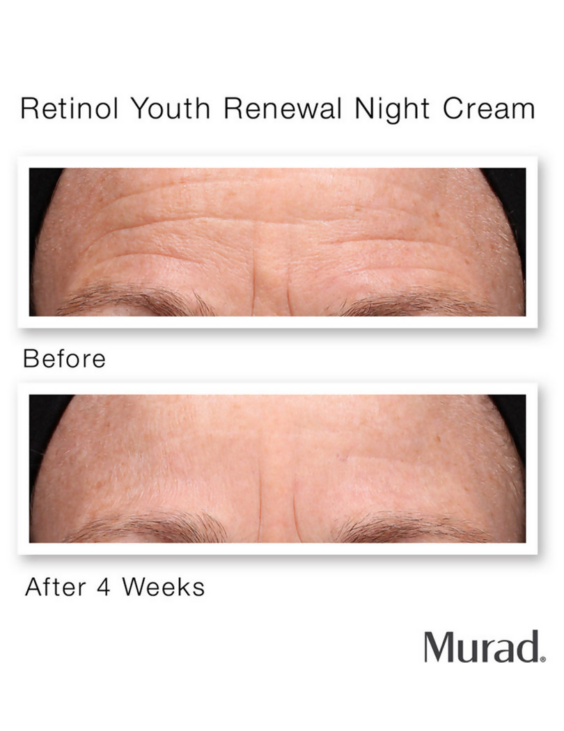 Murad Retinol Youth Renewal Night Cream - Distacart