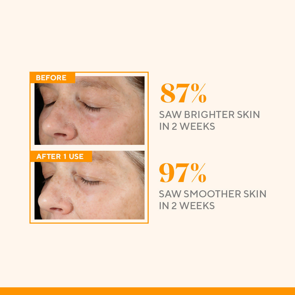 Murad Environmental Shield Vitamin C Triple Exfoliating Facial - Distacart