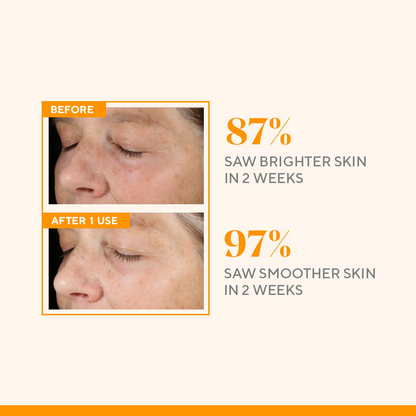 Murad Environmental Shield Vitamin C Triple Exfoliating Facial - Distacart