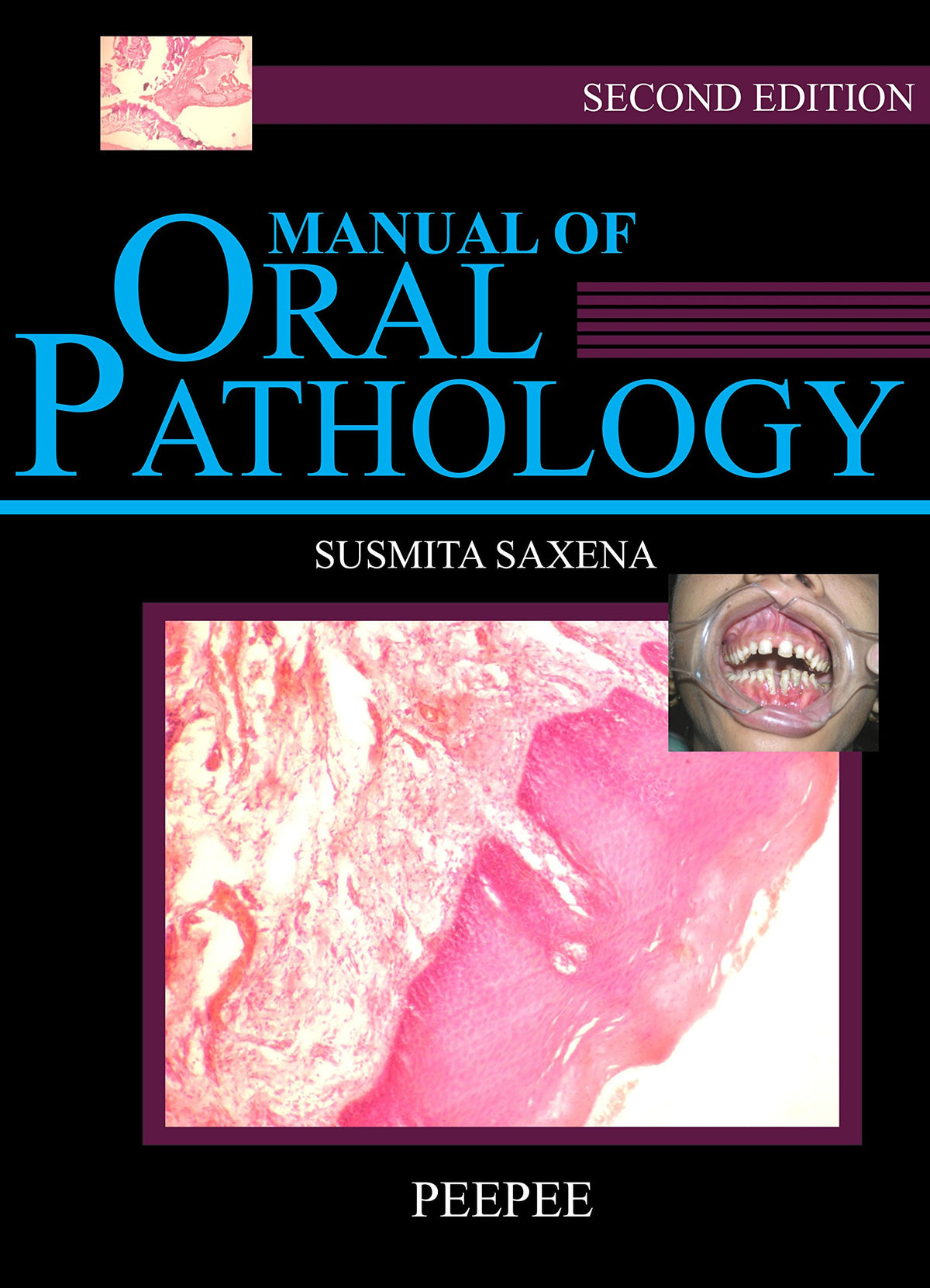 Manual Of Oral Pathology-Sushmita Saxena - Dista
