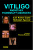 Vitiligo And Other Pigmentary Disorders-Lalit Gupta - Dista