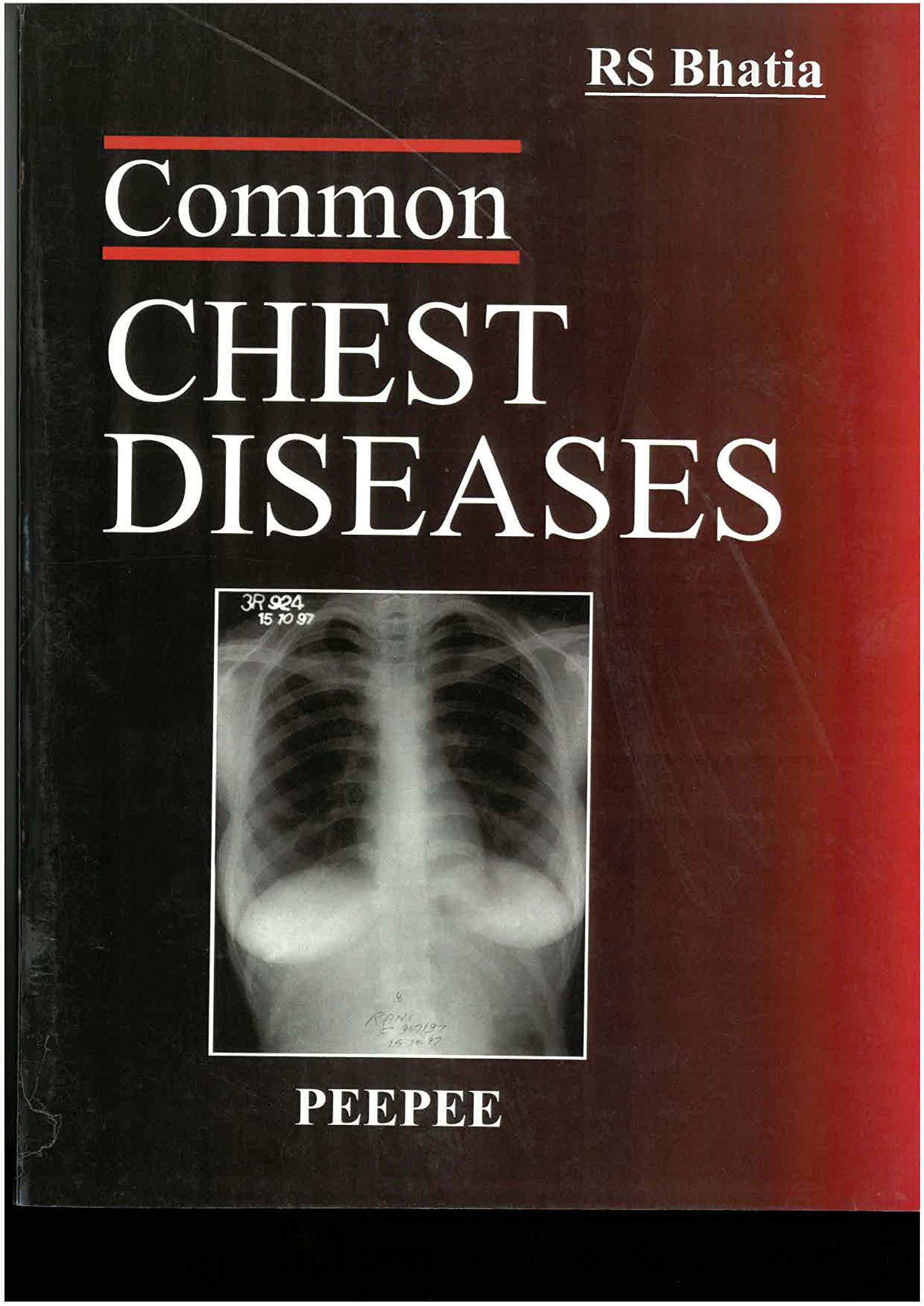 Common Chest Diseases-Bhatia, RS - Dista