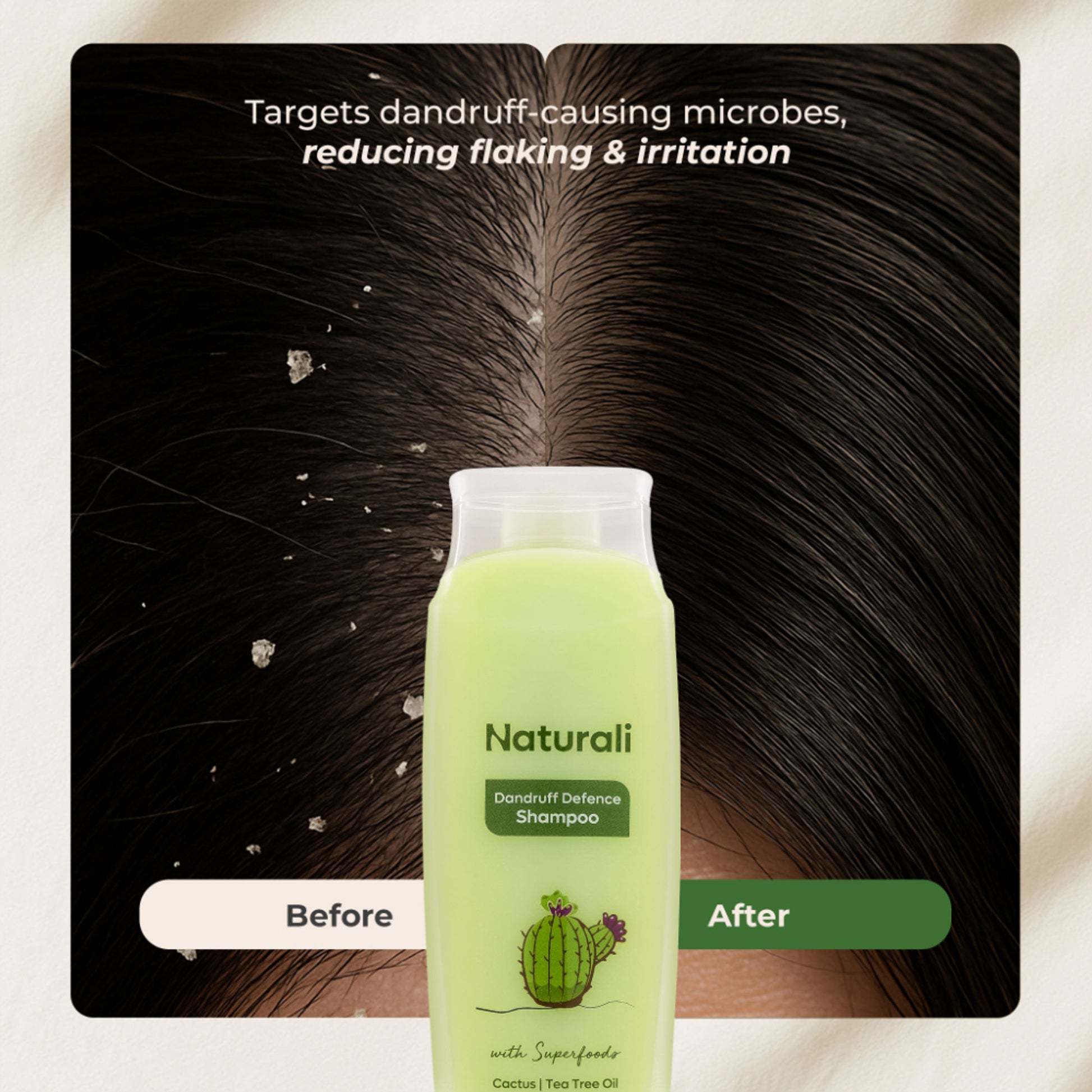 Naturali Dandruff Defence Shampoo with Tea Tree Oil & Cactus Extracts - Distacart