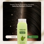 Thumbnail for Naturali Dandruff Defence Shampoo with Tea Tree Oil & Cactus Extracts