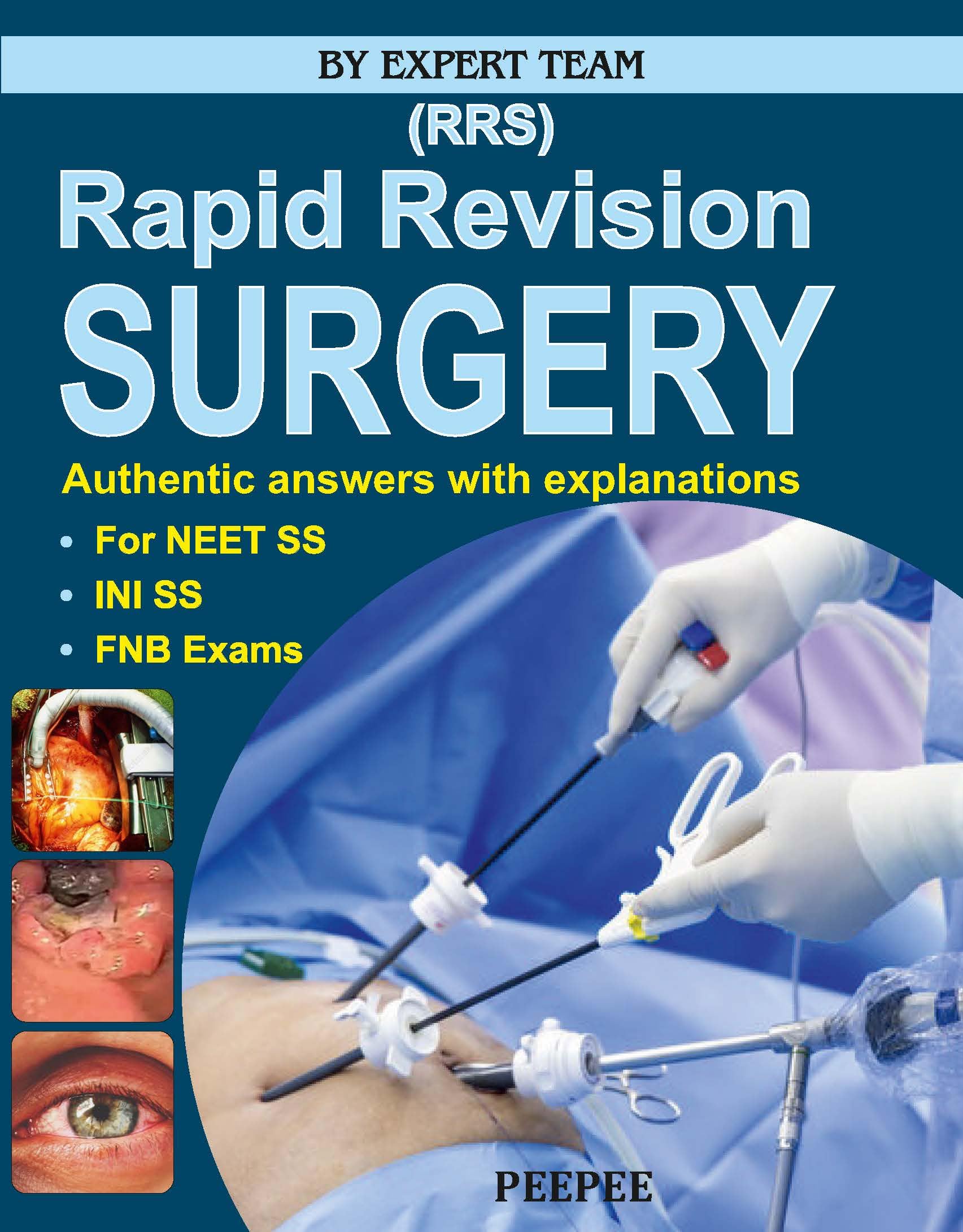 Rapid Revision Surgery For Neet SS Exam-Kantamani, Teja - Dista