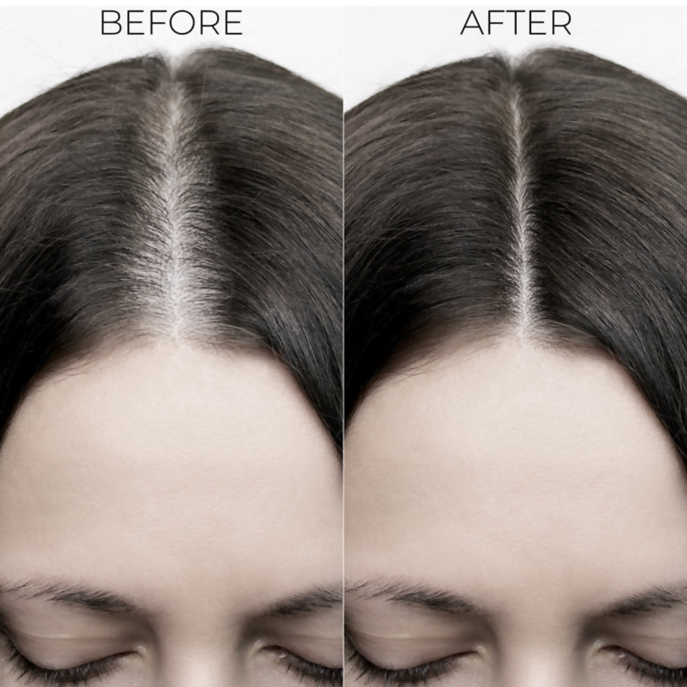Brillare Complete Hair Fall Control kit - Dista