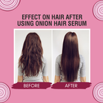 Thumbnail for Nuerma Science Onion Hair Serum with Jaborandi Oil - Distacart