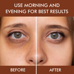 Thumbnail for Nuerma Science Under Eye Gel Massage Roll-On to Reduce Dark Circles, Soothes Puffy Eyes