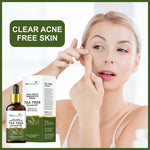 Thumbnail for She Essentials Tea Tree Essential Oil For Active Acne & Pimples, Blemishes & Flakes, Organic & Pure