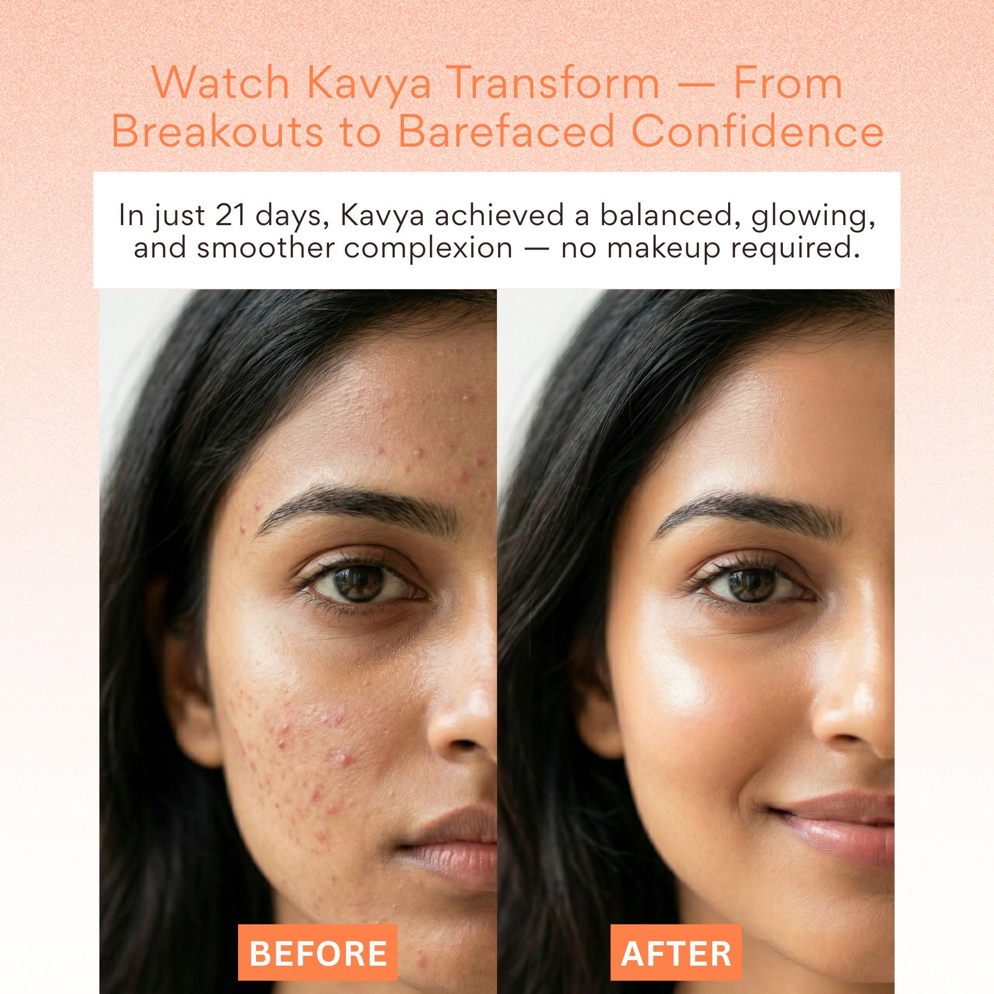 EOB 20% Vitamin C Serum with Hyaluronic Acid Face Serum - Distacart