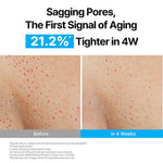 Thumbnail for Innisfree 1% Retinol Green Tea VEGAN PDRN Ampoule - Anti-Aging, Brightening & Skin-Soothing Serum