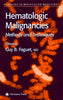 Image 1 of Hardcover for the product Hematologic Malignancies - Guy B. Faguet