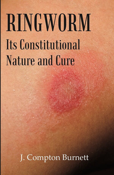 Ringworm: Its Constitutional Nature and Cure - Gyan Books - Distacart