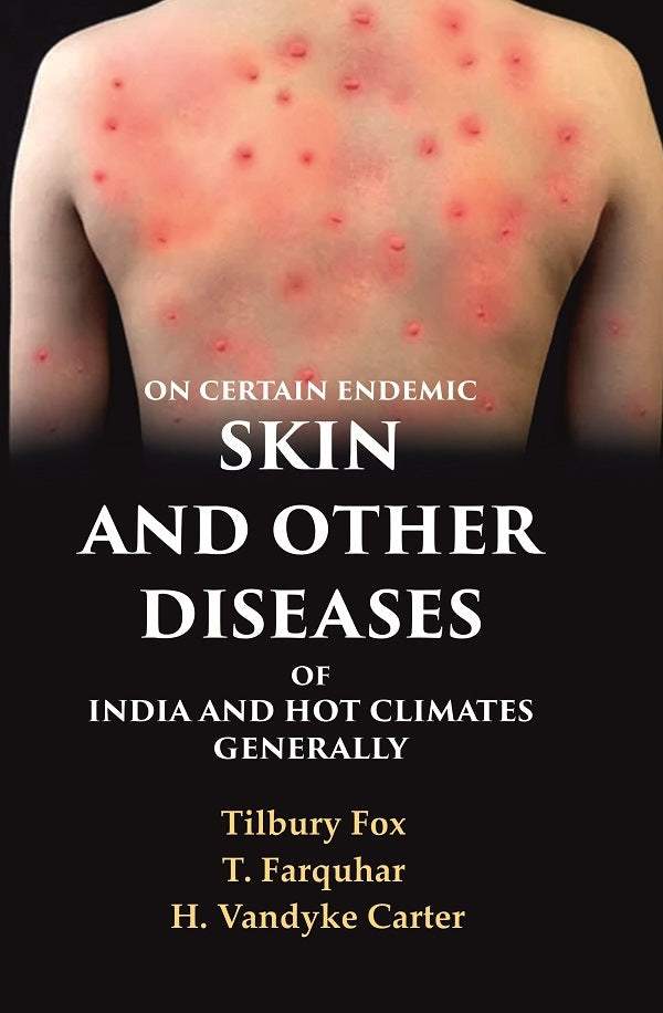 On Certain Endemic Skin and Other Diseases of India and Hot Climates Generally - Gyan Books - Distacart