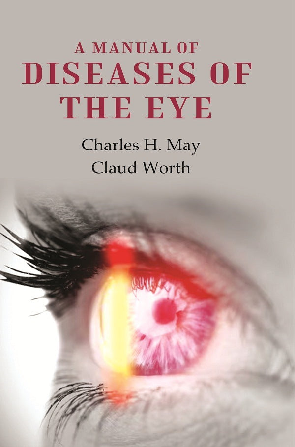 A Manual of Diseases of the Eye - Gyan Books - Distacart