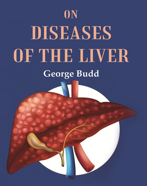 On Diseases of the Liver - Gyan Books - Distacart