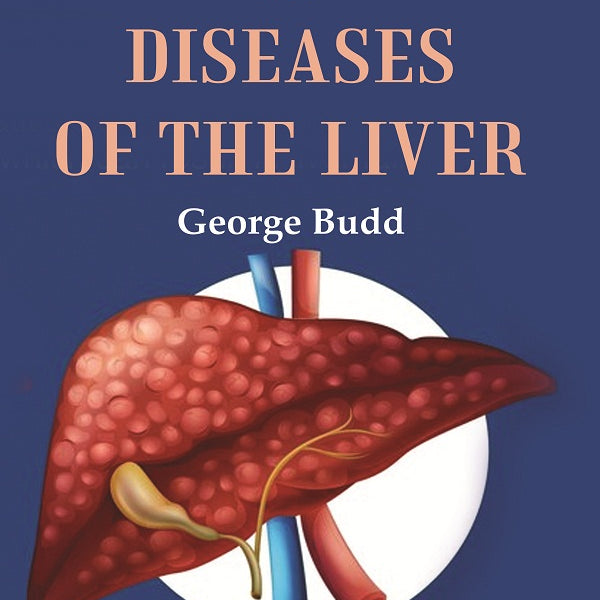 On Diseases of the Liver - Gyan Books - Distacart