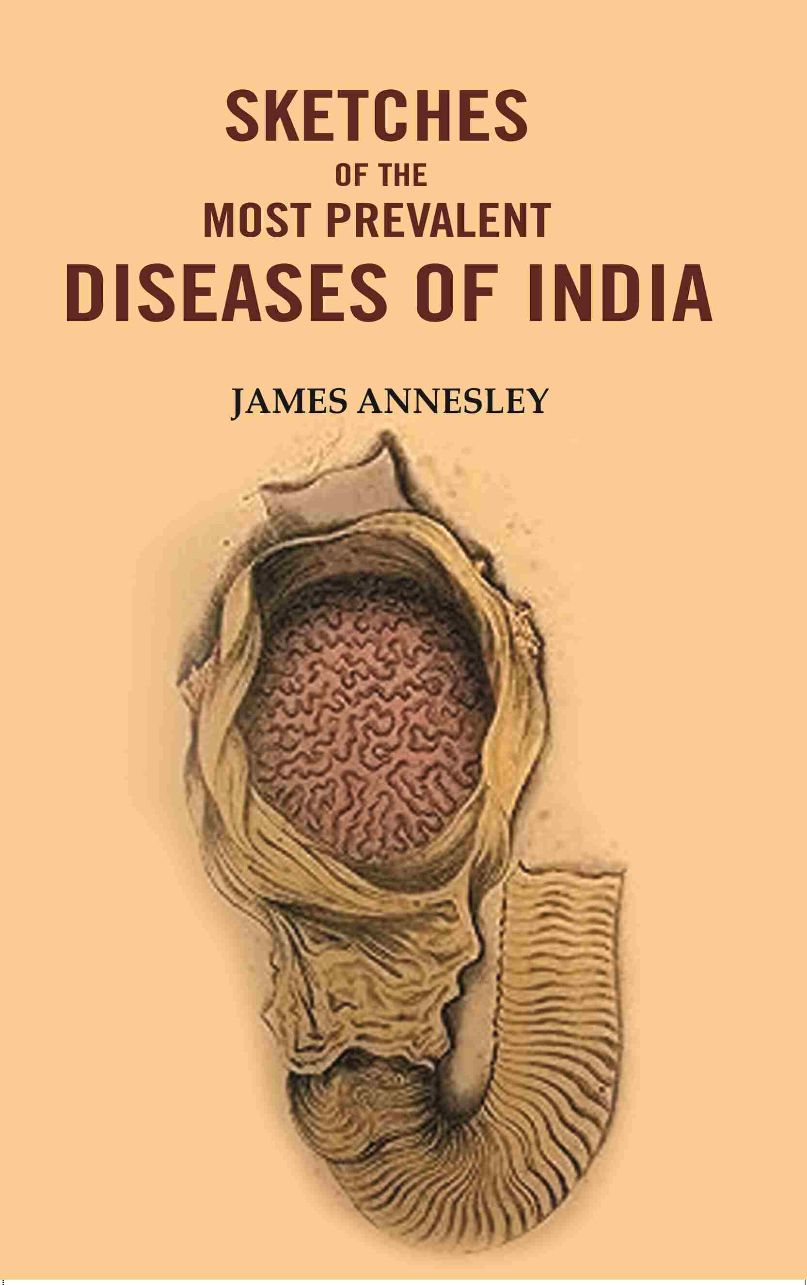 Sketches of the Most Prevalent Diseases of India - Gyan Books - Distacart