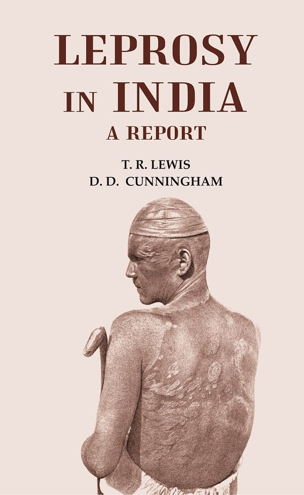 Leprosy in India - Gyan Books - Distacart