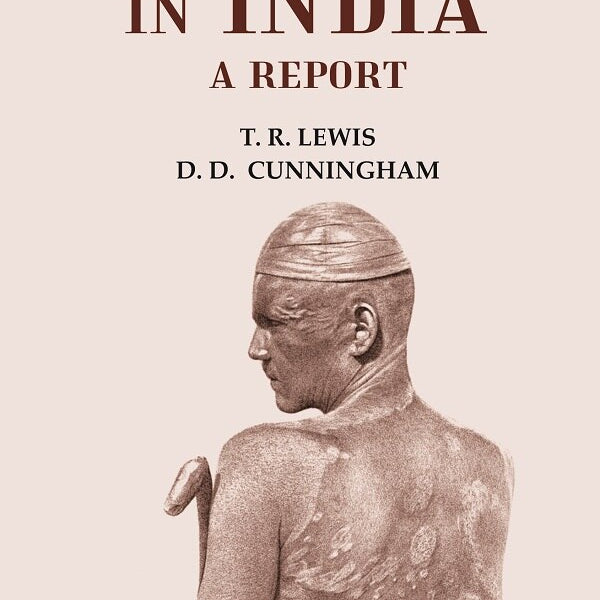 Leprosy in India - Gyan Books - Distacart