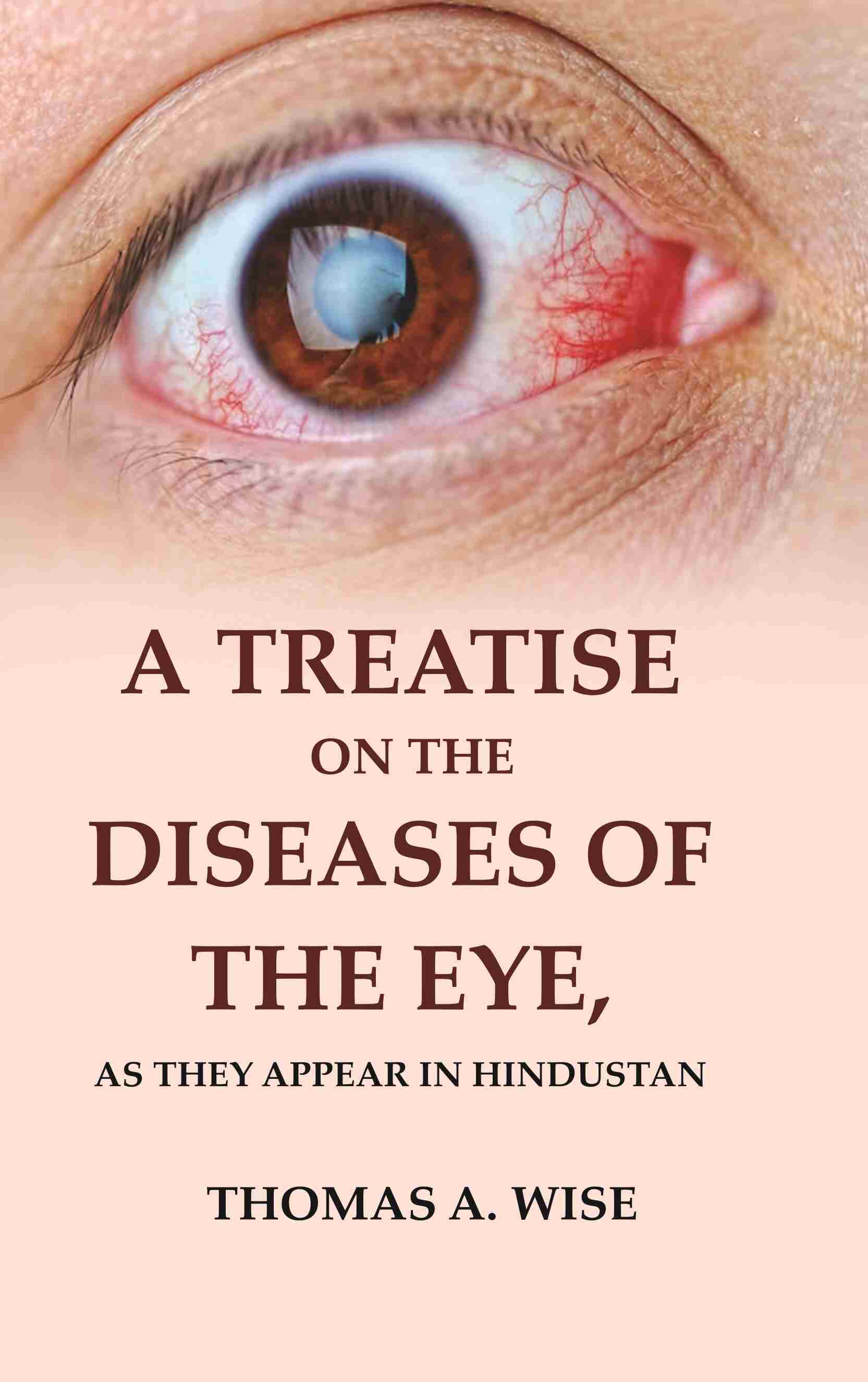 A Treatise on the Diseases of The Eye: As they appear in Hindustan - Gyan Books - Distacart