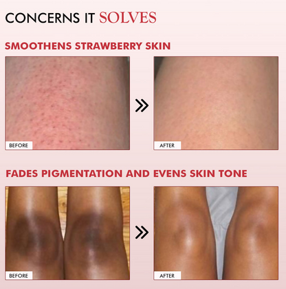 mCaffeine 11% AHA-BHA Skin Smoothening Strawberry Body Lotion - Distacart